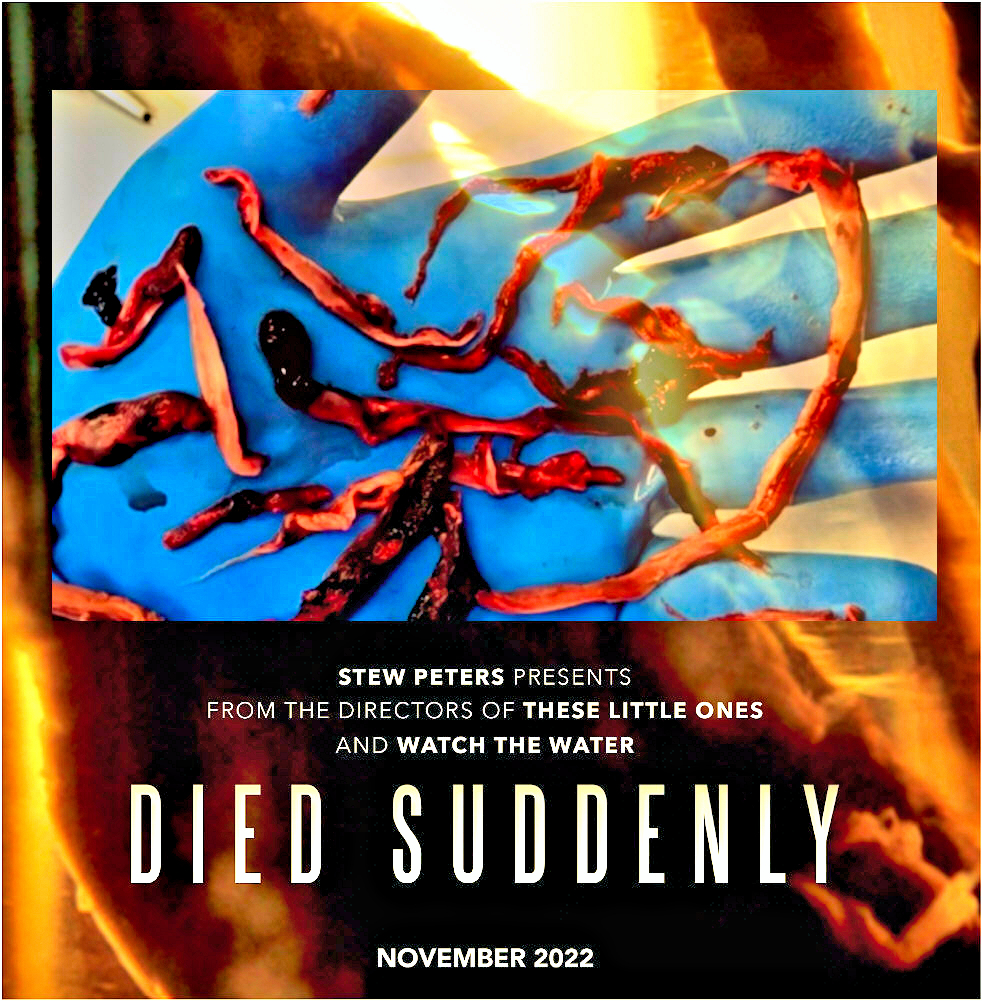 Read more about the article DOCUMENTARY : COVID VACCINES “DIED SUDDENLY”